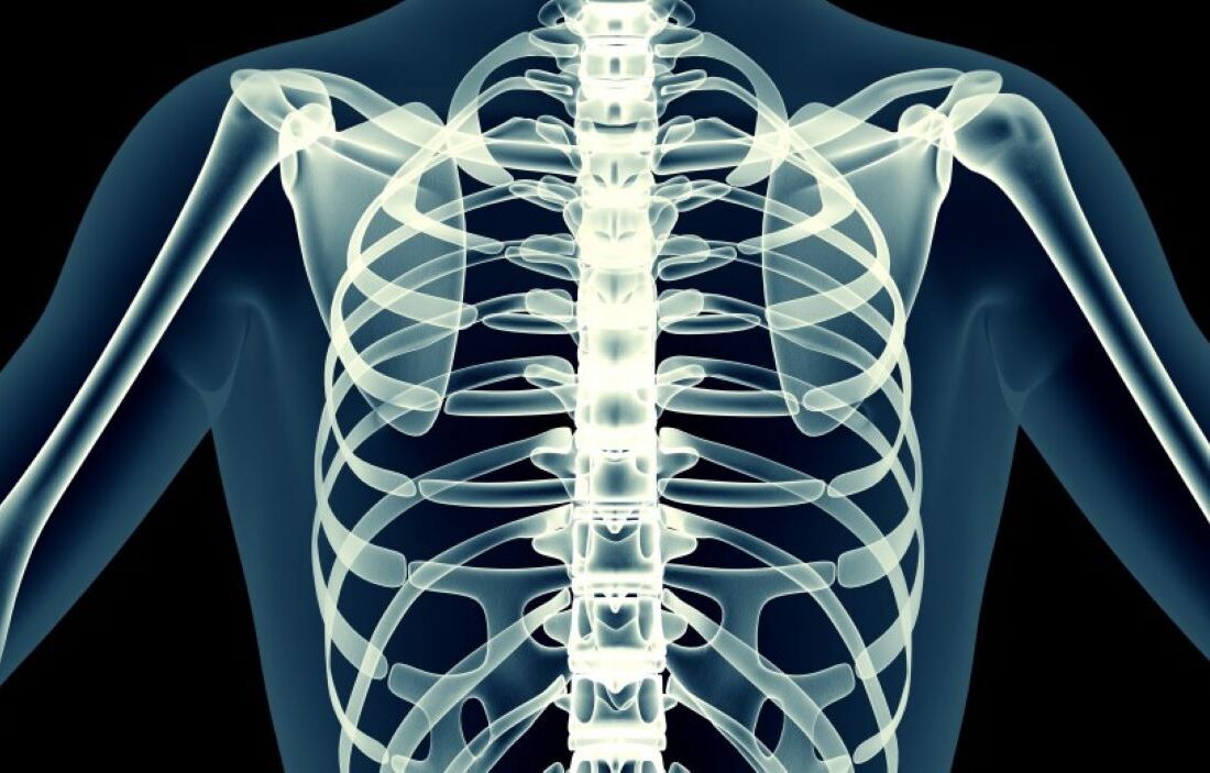 chest x-ray