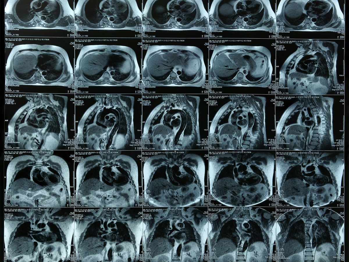 collage of MRI images