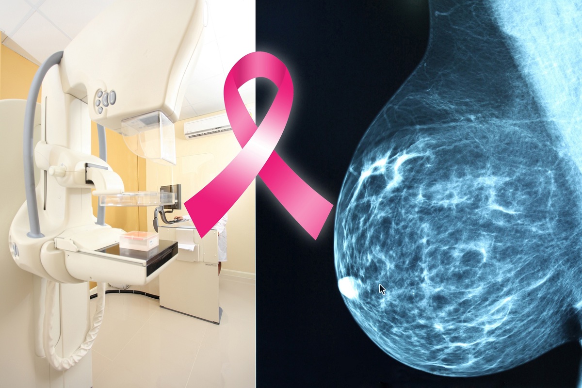 mammogram machine and mammogram image of breast with breast cancer ribbon in middle of collage