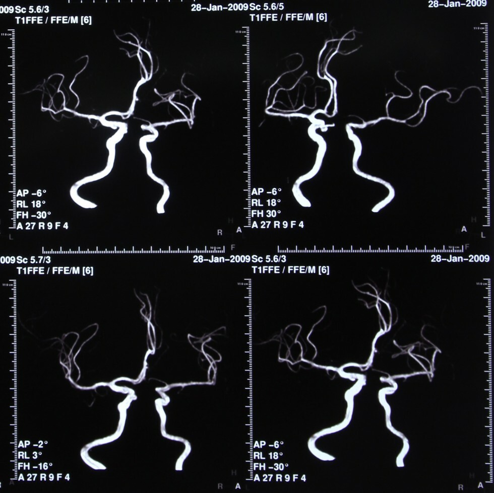 Resources - For Patients - FAQs: MRI | Professional Radiology