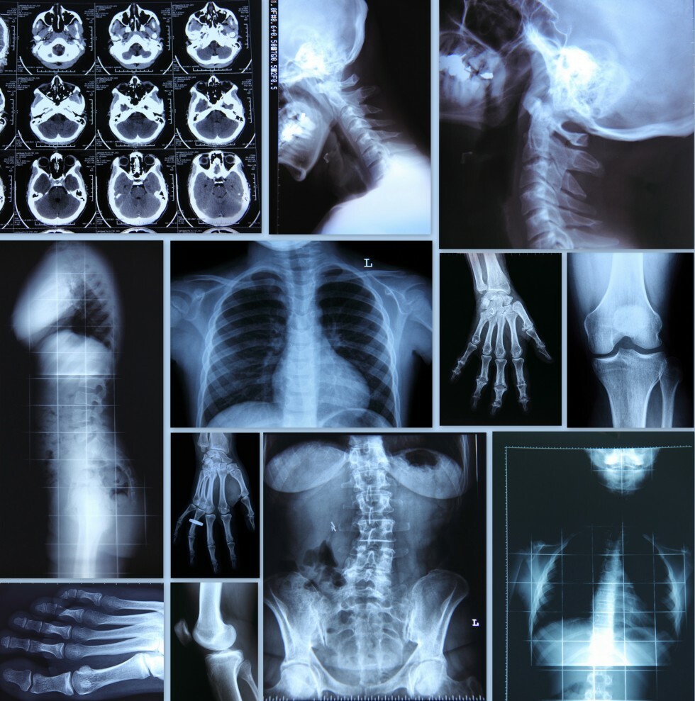 collage of xrays